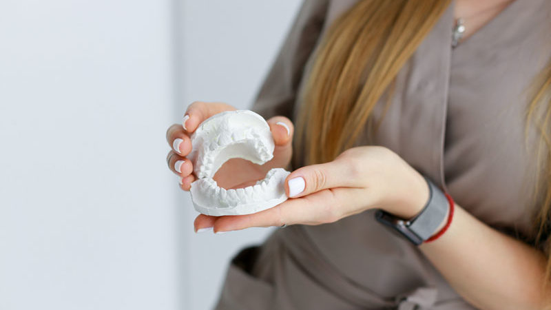 dental implant model of a set of full mouth dental implants.